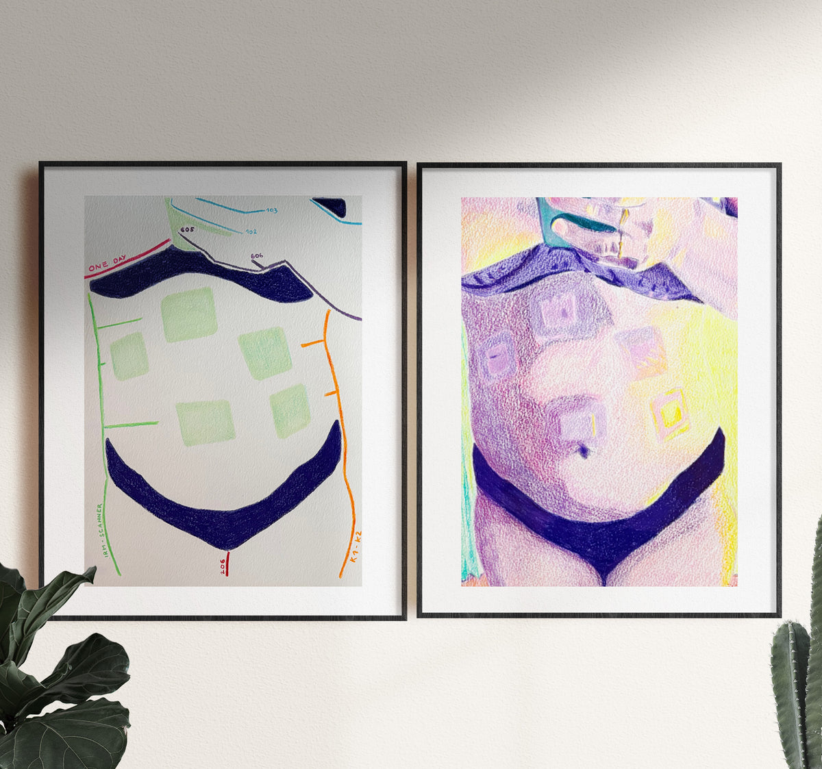 Diptyque Errance : deux dessins originaux aux crayons de couleur représentant un ventre marqué par l’endométriose, présentés encadrés côte à côte.